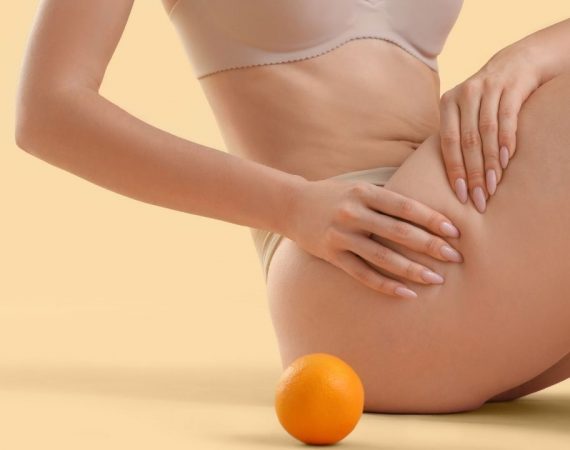 ADDIO CELLULITE! 3 Trucchi per una pelle più liscia e tonica! | Pelle buccia d’arancia